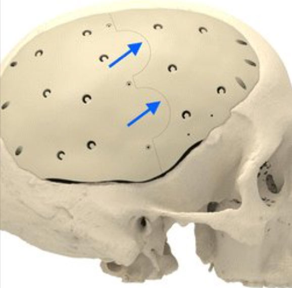 from-human-skeleton-to-mars-rover-how-does-jwell-machinerys-peek-plate-and-rod-extrusion-line-shape-the-peak-value-of-the-king-of-plastics6.jpg from-human-skeleton-to-mars-rover-how-does-jwell-machinerys-peek-plate-and-rod-extrusion-line-shape-the-peak-value-of-the-king-of-plastics6.jpg